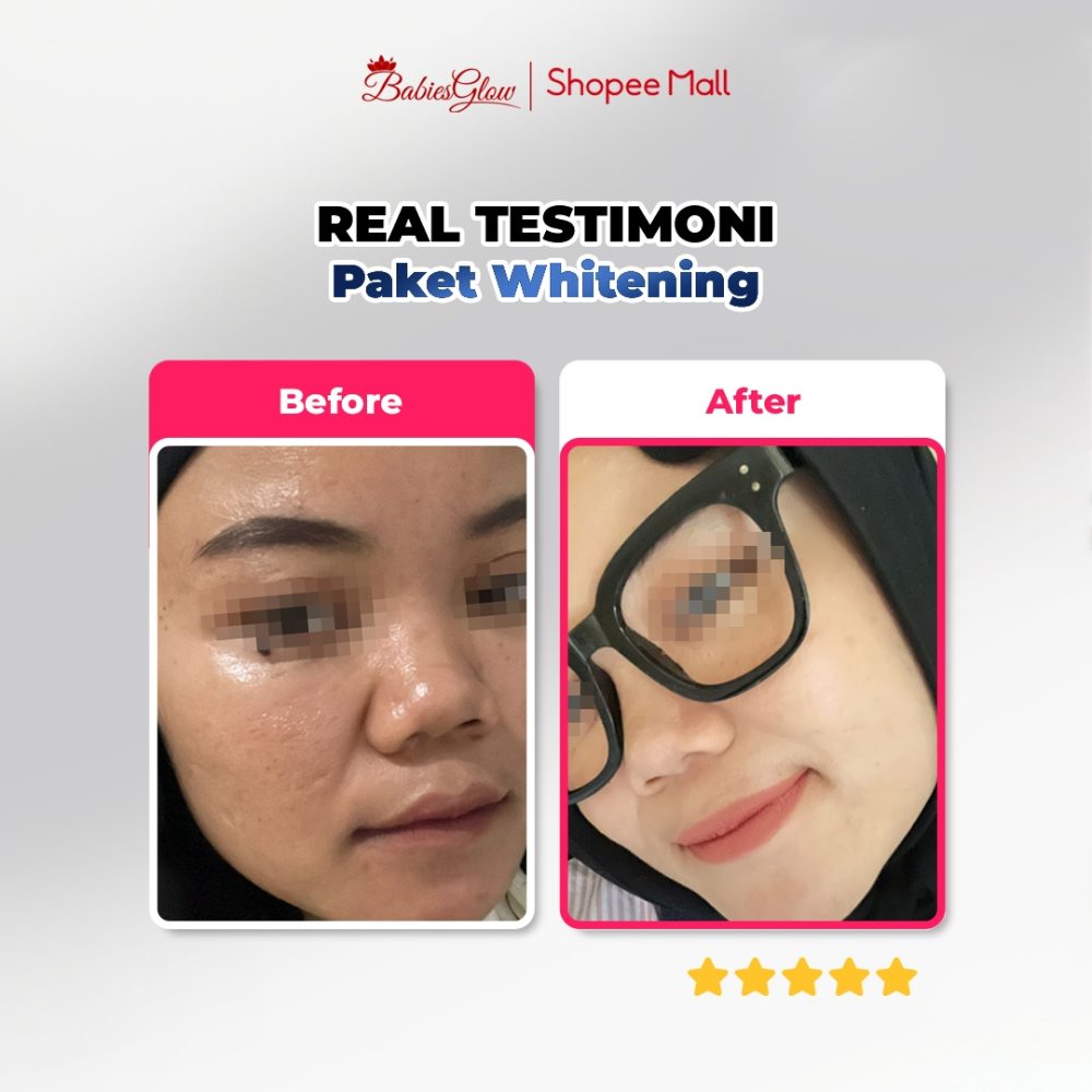 Landing Page Paket NEW Whitening Series_03.jpg