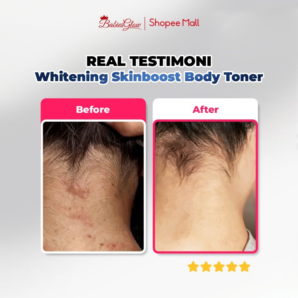 Landing Page Whitening Skinboost Body Toner_03.jpg